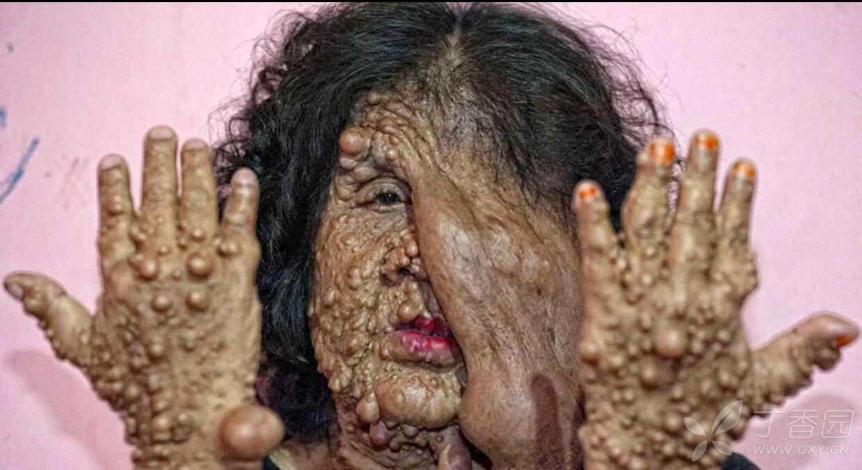 典型:看了能记住一辈子的图片