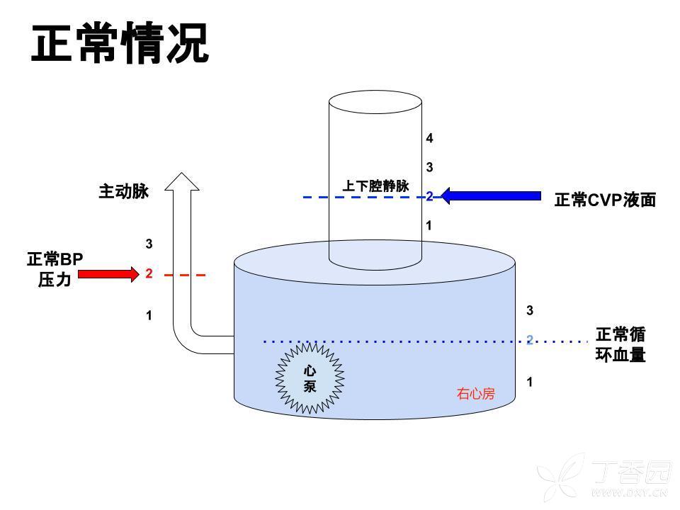 通俗易懂解释补液试验(图解)