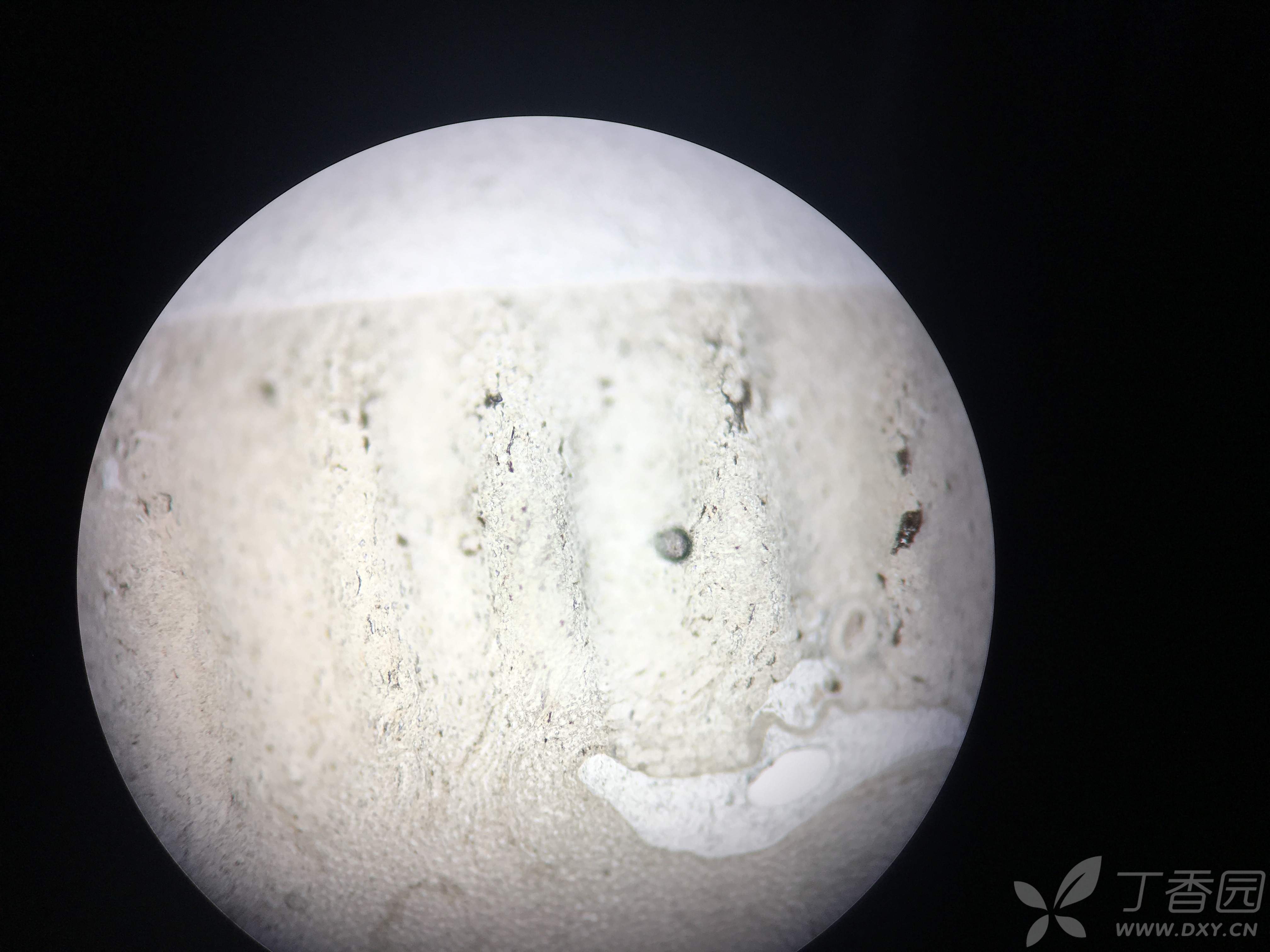 石蜡切片求大神指点