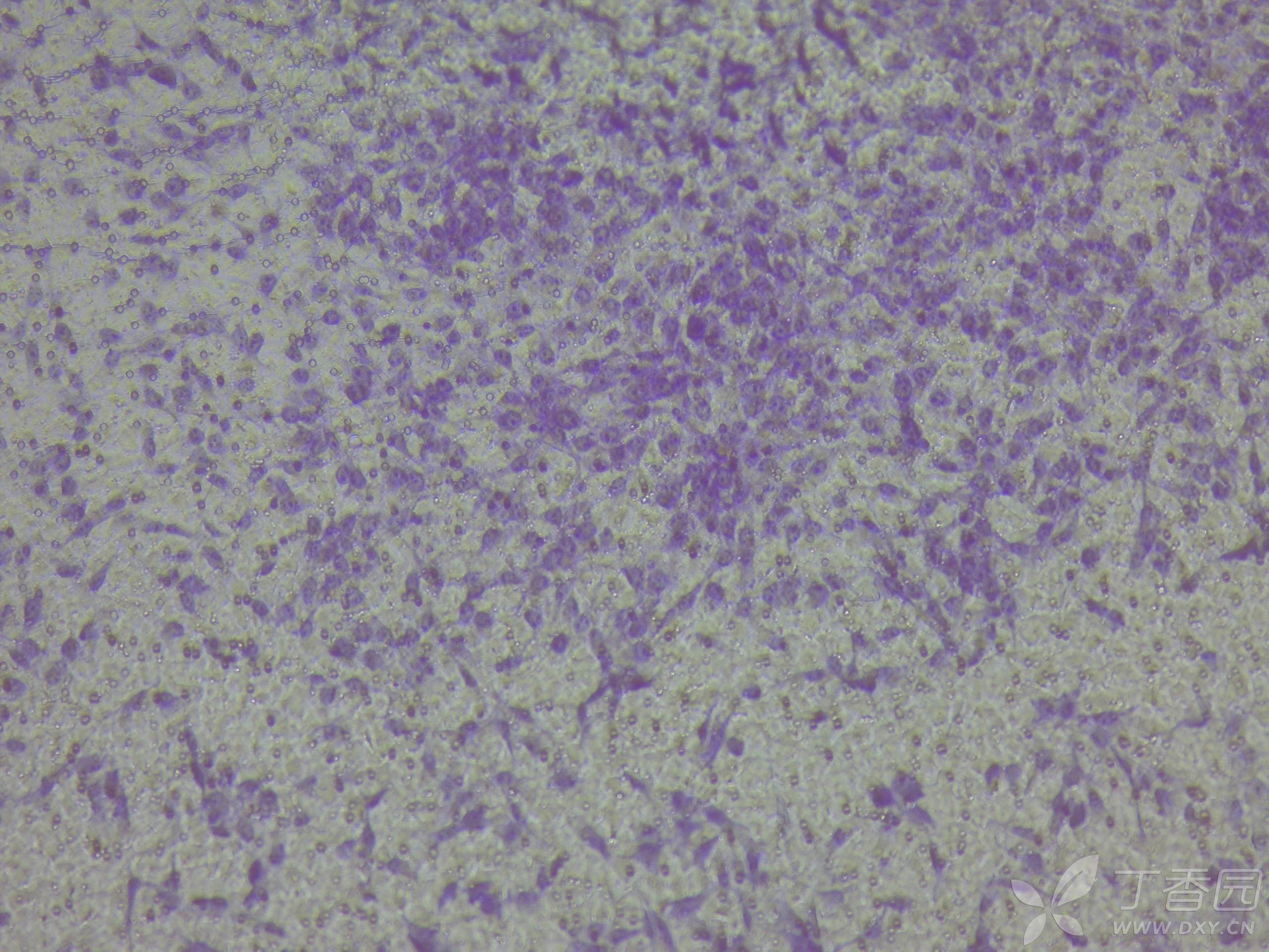 细菌生物膜结晶紫染色图片