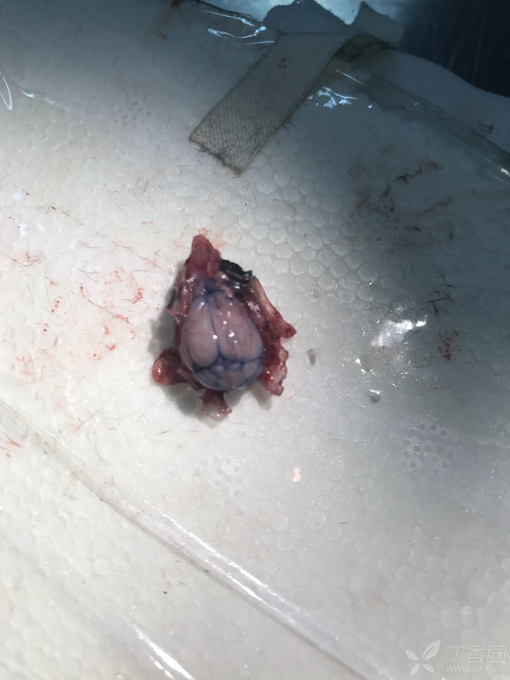 各位战友,我是实验菜鸟一枚,实验需要侧脑室注射药,取海马,取脑脊液.