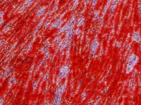 干细胞诱导分化