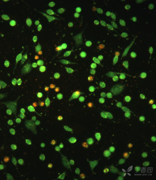 求各位大牛帮忙分析下,ao/eb双染的图片,在此跪谢大家!