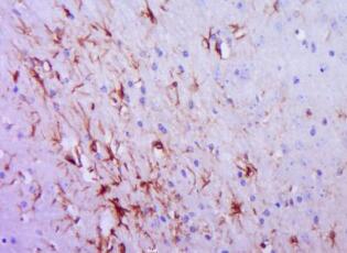轴突蛋白4|少突胶质细胞免疫荧光抗体