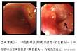 协和病例：上消化道梗阻、黄疸、胰腺病变，是……