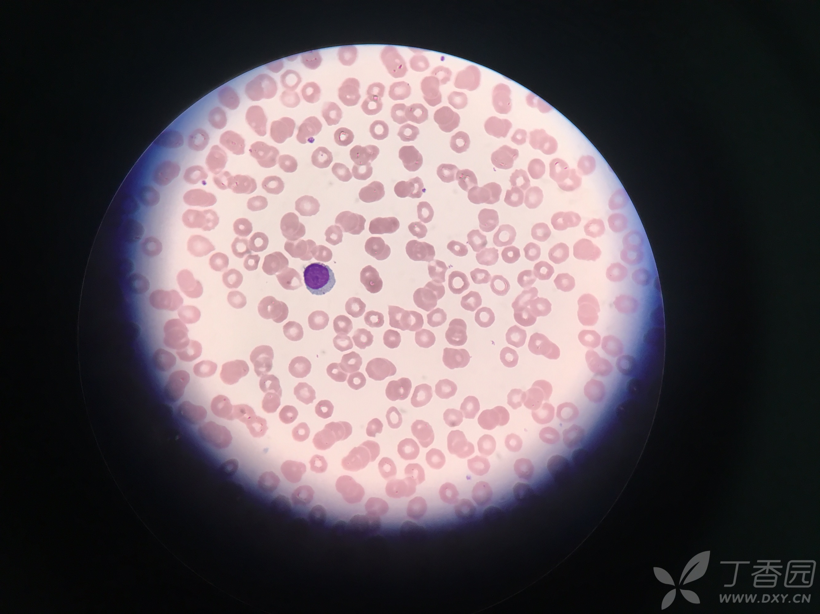 单核细胞光镜图图片