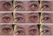 看似「寻常」的复视，「真凶」却是它