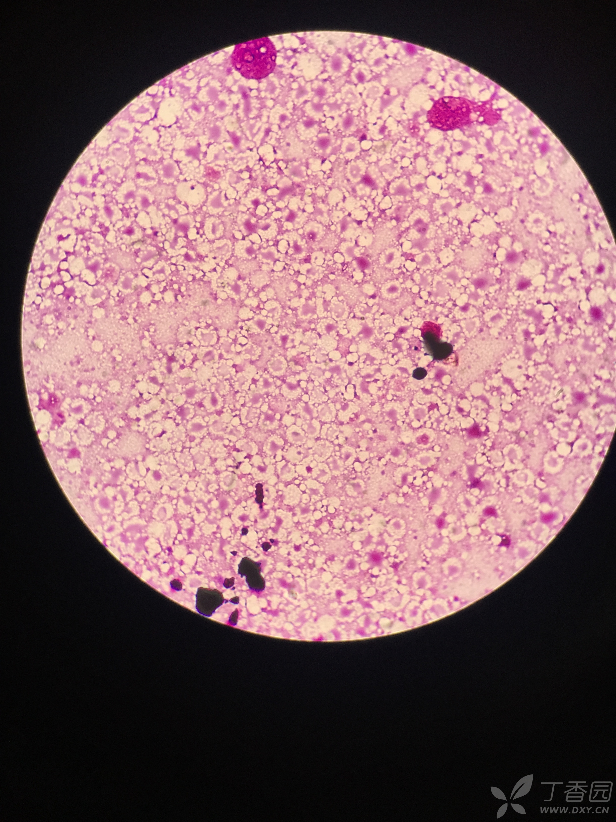 猪肝显微镜下的细胞图图片