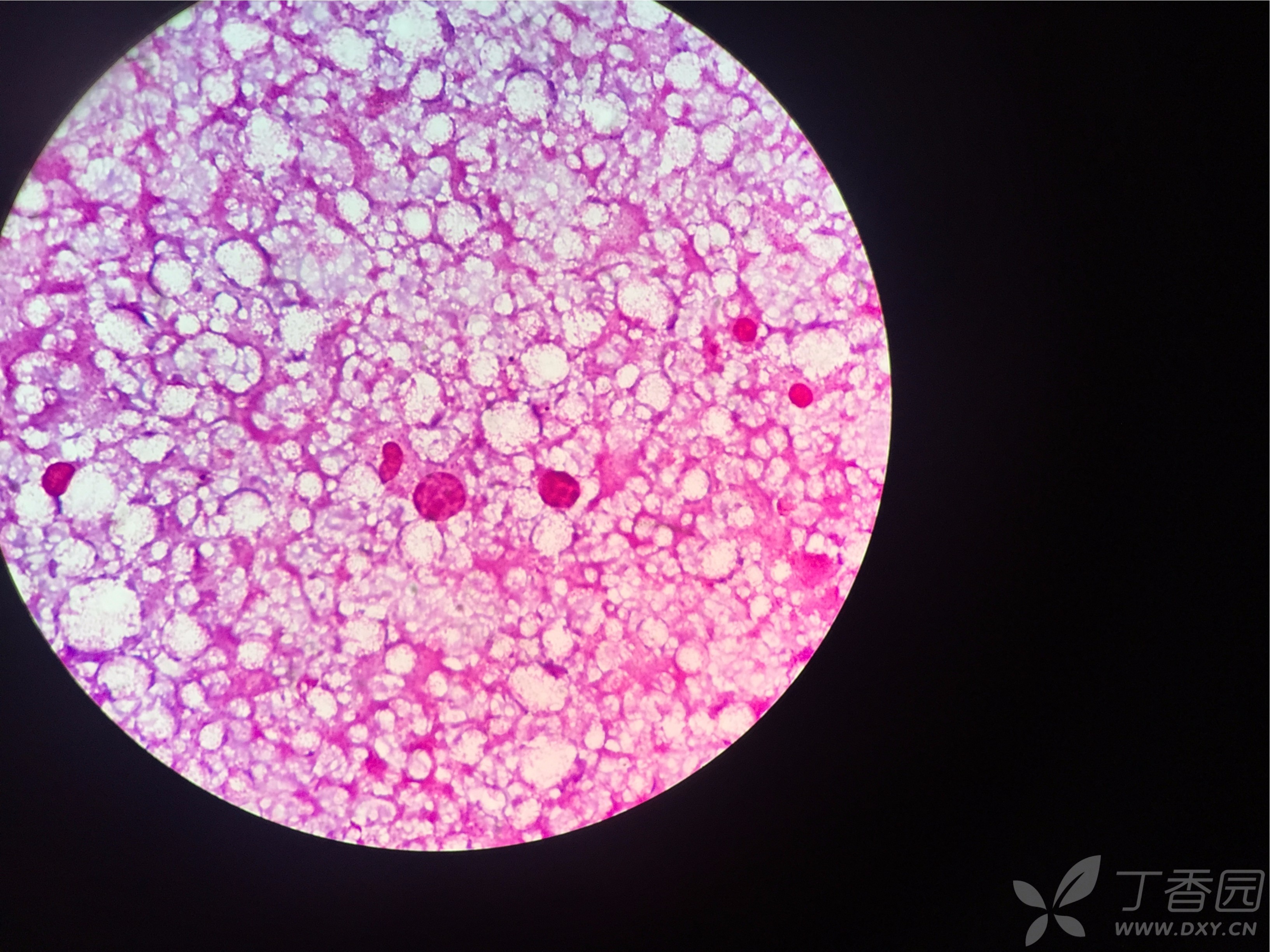 肝细胞切片图图片