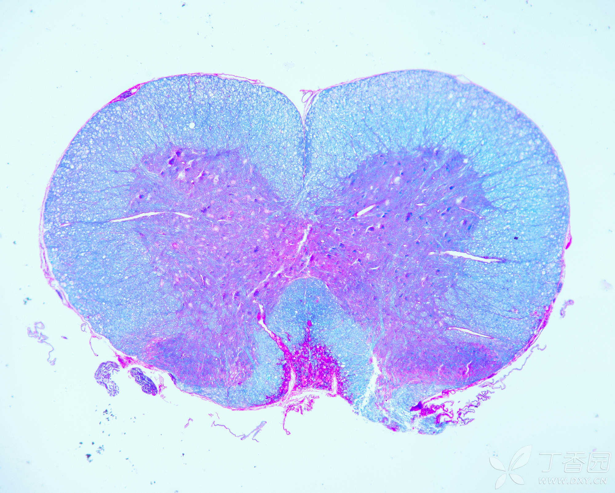 神经组织学经验-3 多发性硬化等神经脱髓鞘病变的组织学染色方法
