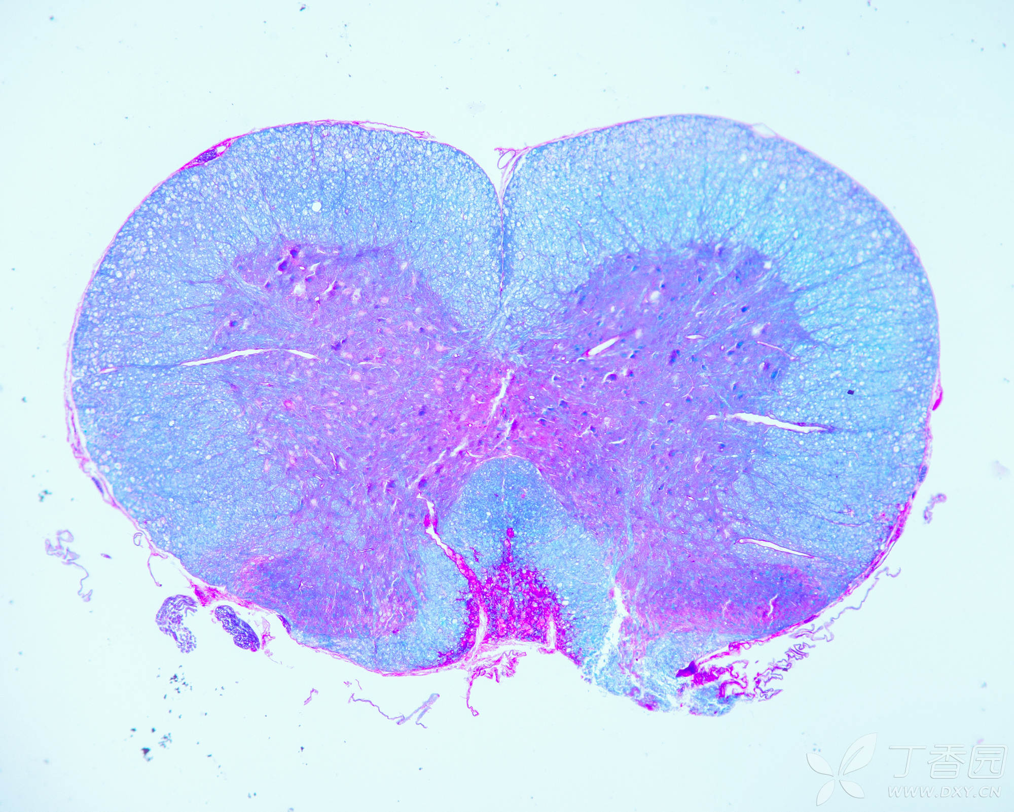 脊神经节切片图片图片