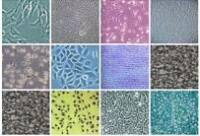 人膀胱癌细胞，5637