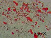 J558(小鼠多发性骨髓瘤细胞)