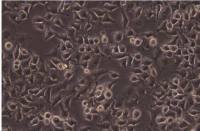 人脑胶质瘤细胞，A172