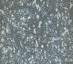 人肾透明细胞癌细胞,786-O(786-0)