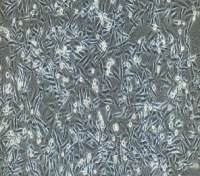 人肾透明细胞癌细胞，786-O(786-0)