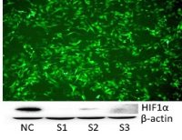 定制RNAi慢病毒服务