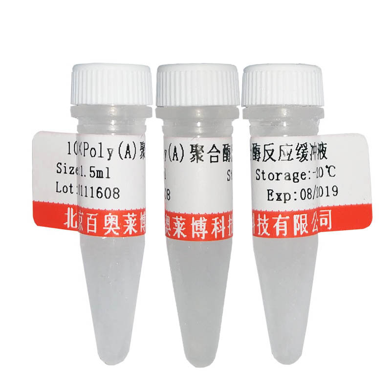 北京SV1488型Remove-iT 糖苷内切酶 D现货价格