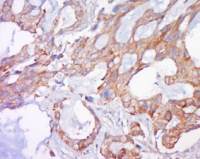 铁调节蛋白25免疫荧光抗体