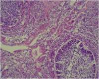 HE染色（组织形态）