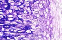 杂交瘤细胞株；α-antitrypsin-P-01品牌