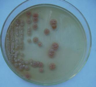 白色链霉菌白色变种保存