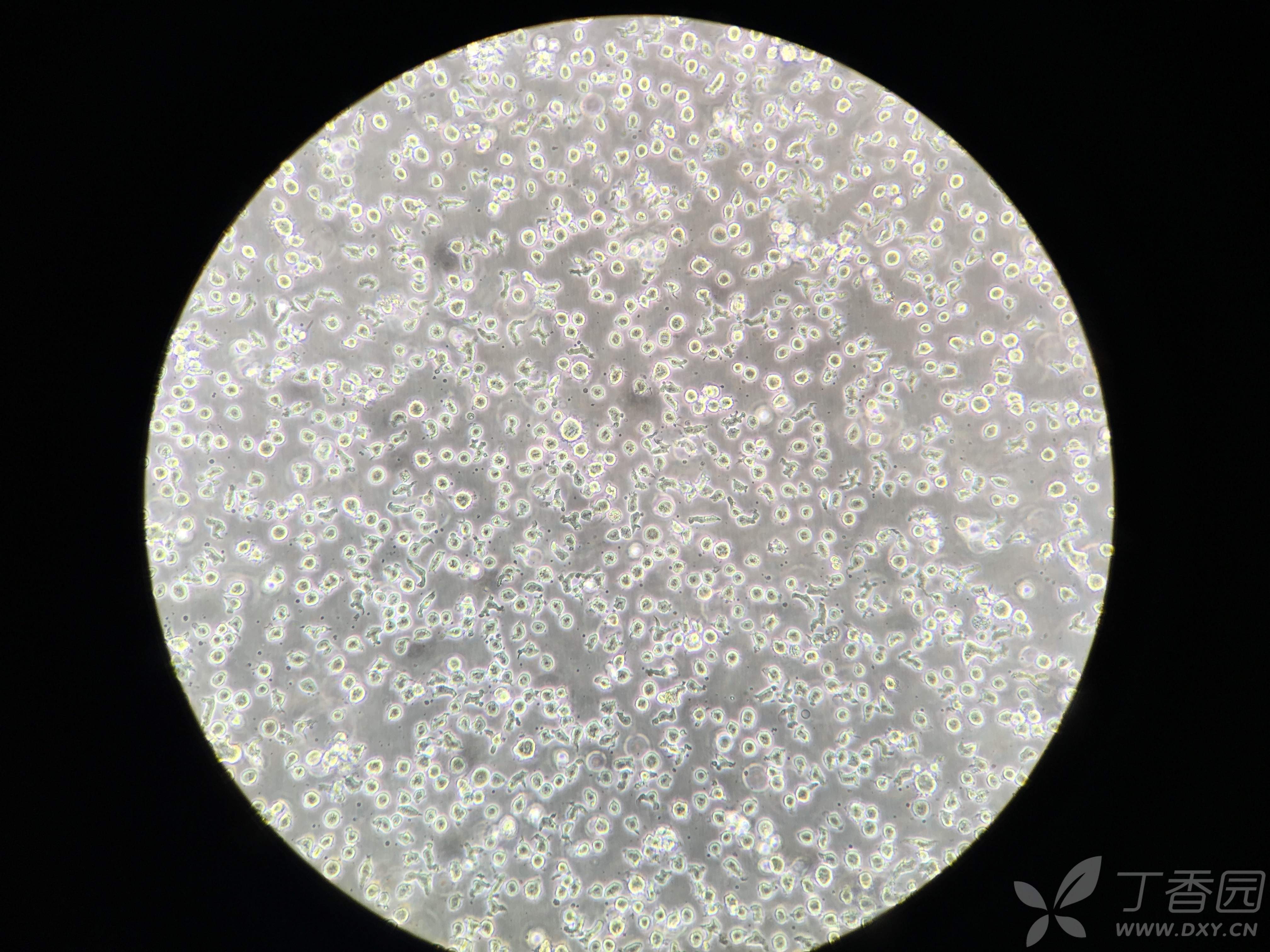 求看看这个thp-1细胞的状态