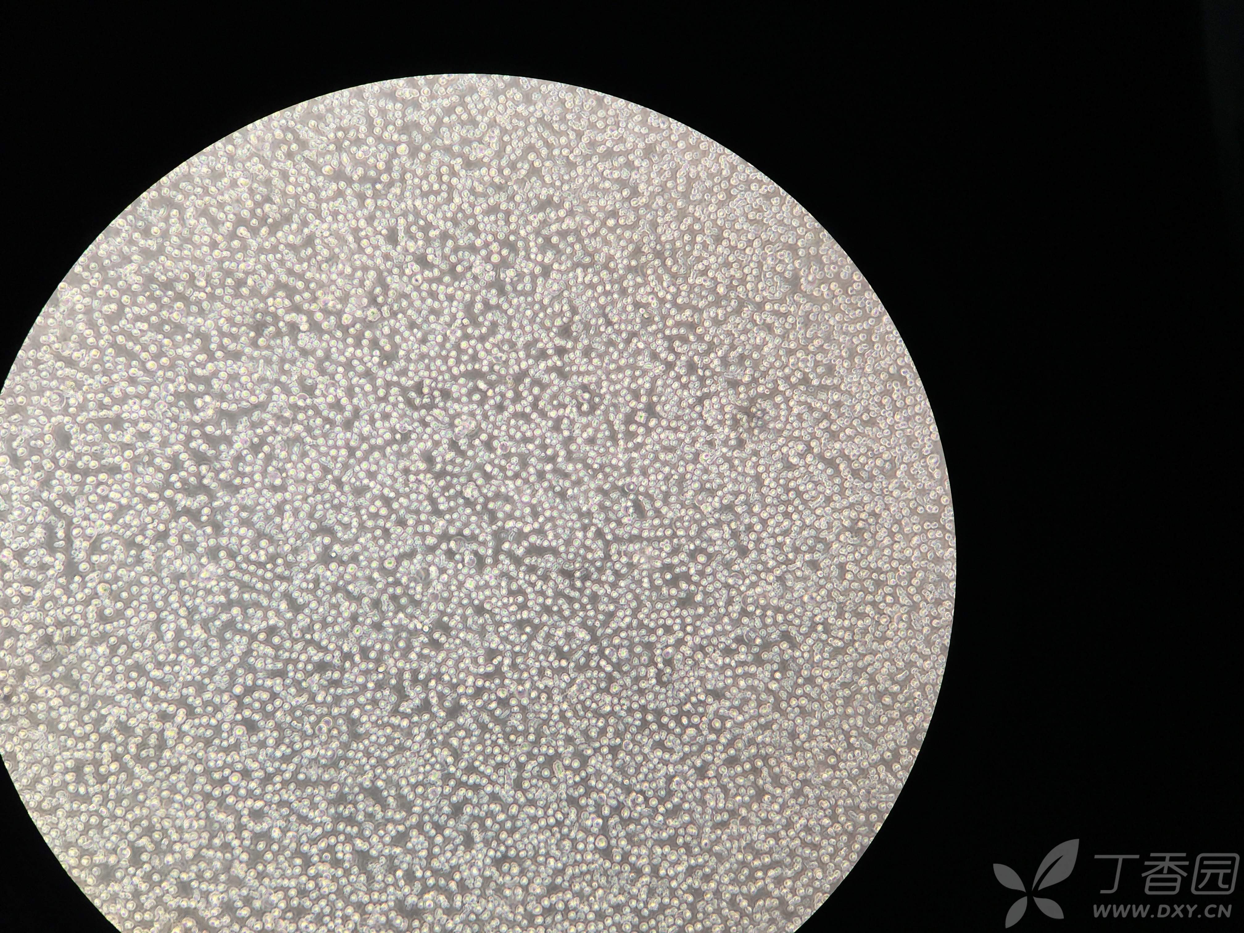 求看看这个thp-1细胞的状态