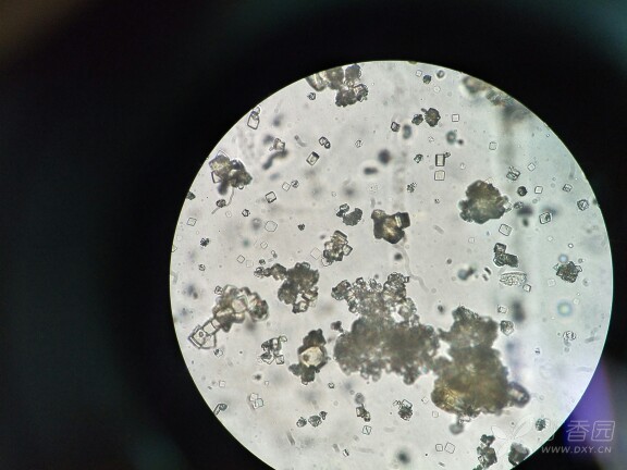 尿液磺胺结晶图片
