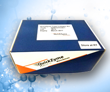 人基质金属蛋白酶7活性检测试剂盒
