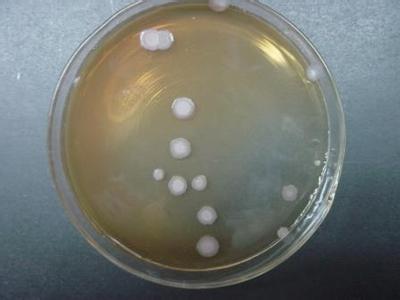 嗜酸乳杆菌保存
