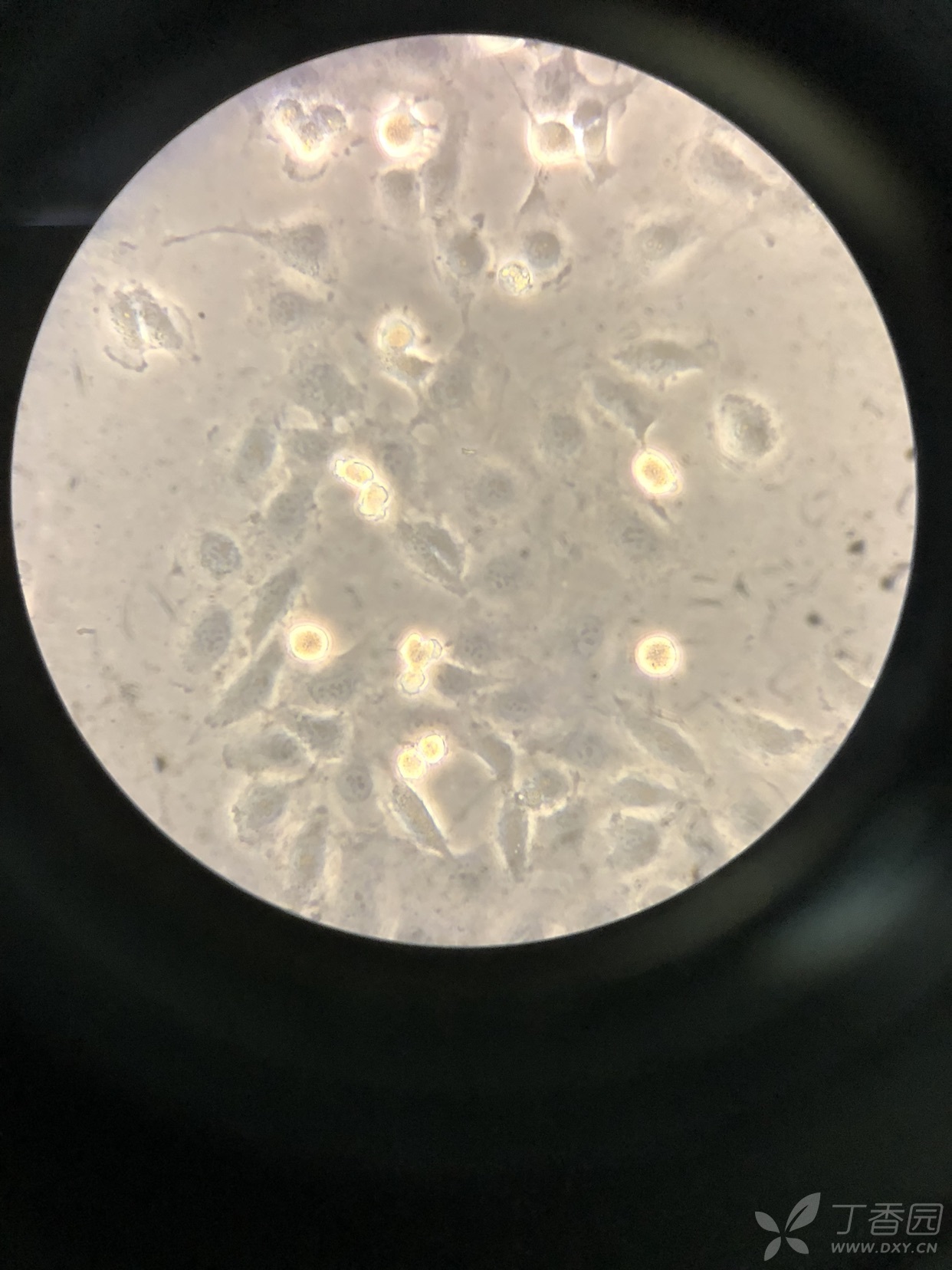 显微镜下出现这种圆圆亮亮的细胞,这种细胞仍旧贴壁,不悬浮,想问一下