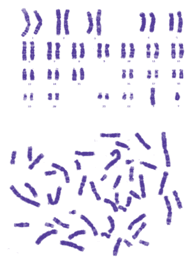 细胞染色体核型分析G-显带