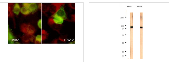 abcam-Anti-HSV1 + HSV2 gB [10B7] antibody
