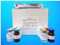 Soluble Lectin-like oxidized low density lipoprotein receptor-1 ELISA Kit (SlOX-1 ELI), Human