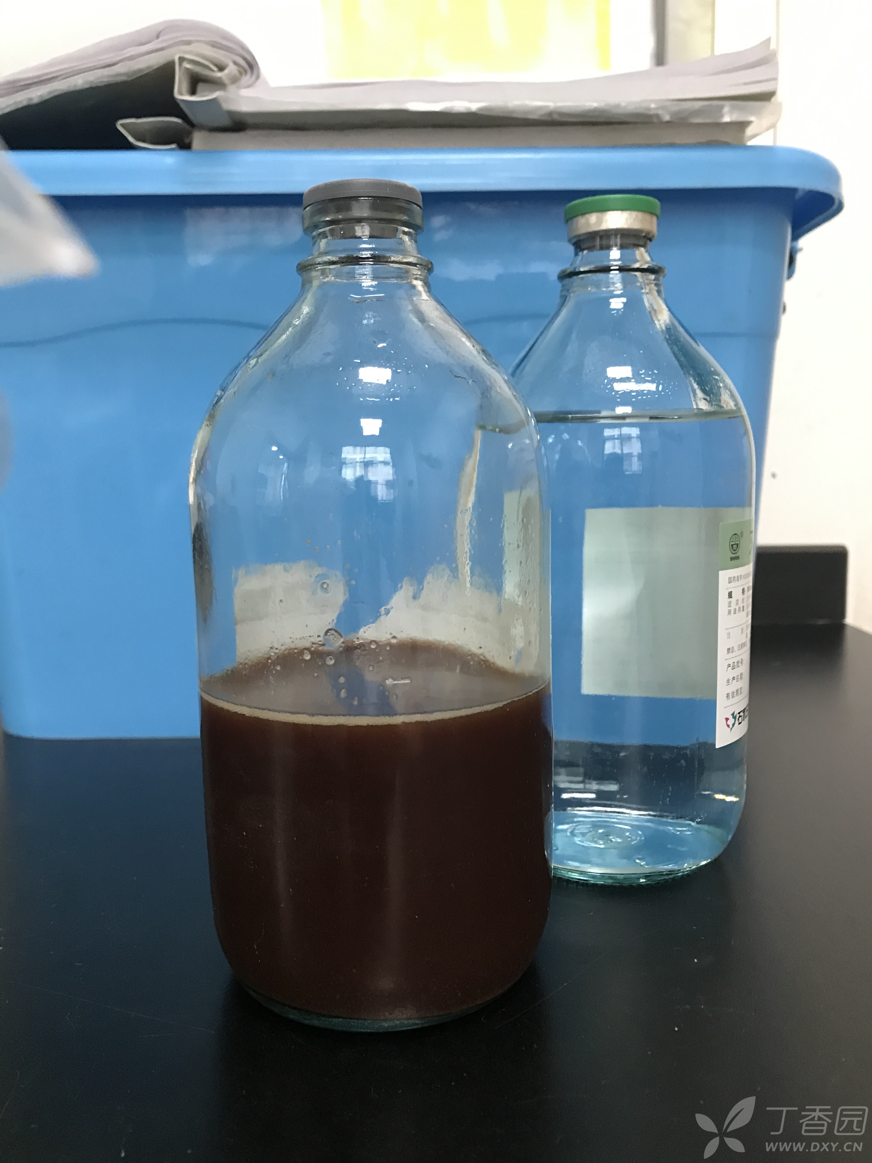 引流右侧胸腔积液为深褐色,其常规生化因粘稠度过高无法计数,胸水cea