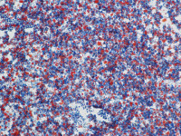 油红O染色（冰切）