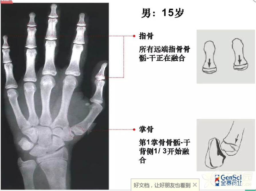 籽骨位置图片