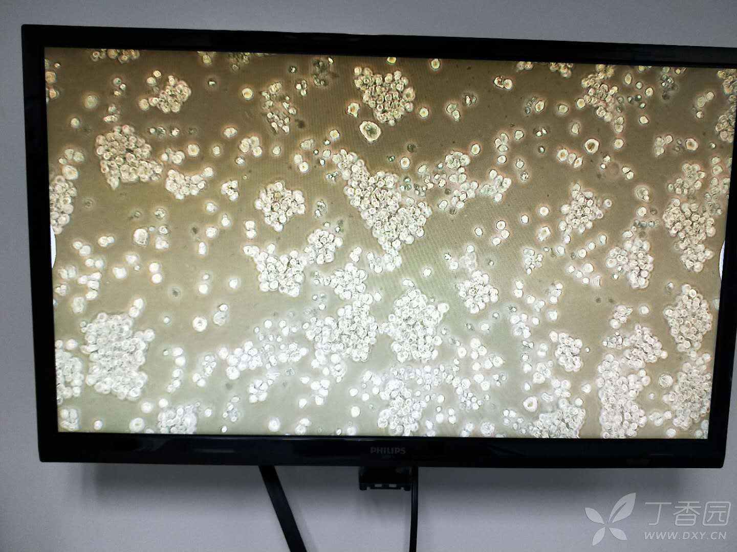 新手刚刚养thp-1细胞,下图是买回来后首次传代后第