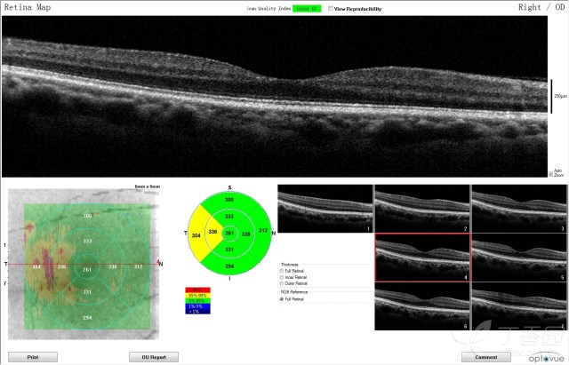 3268413667842276854-8w.jpg!w640