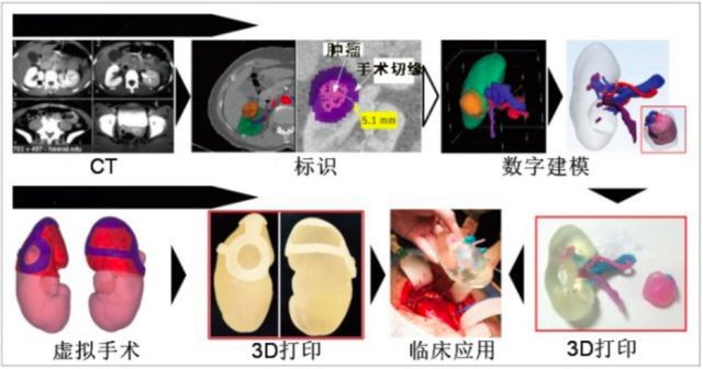 一颗3d nand最大最到多少 3D 打印一颗肾脏离咱们还有多远？