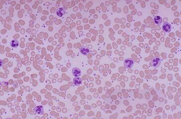 HCCLM3 人高转移肝癌细胞（含STR鉴定）