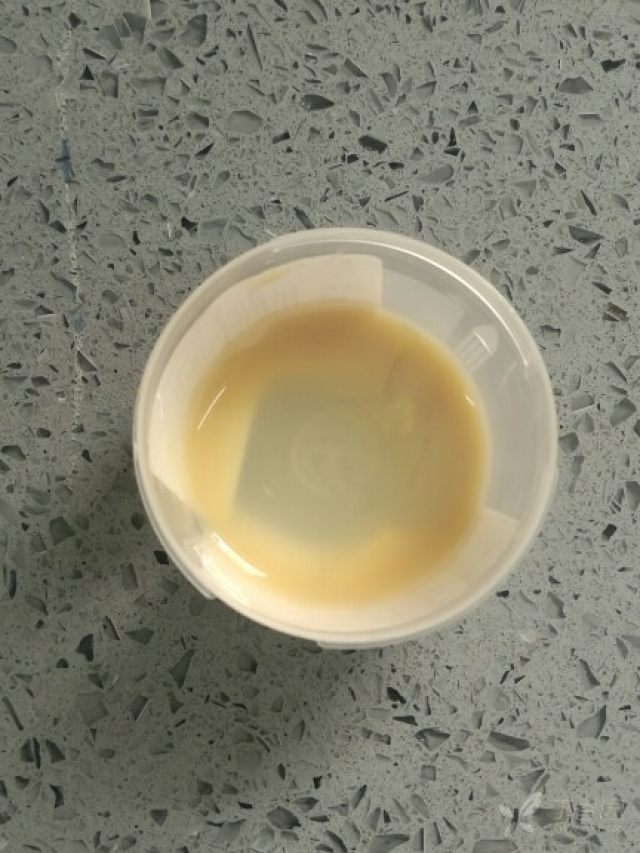 痰标本的性状如图