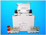 O-6-Methylguanine DNA Methyltransferase ELISA Kit (MGMP), Human产品图