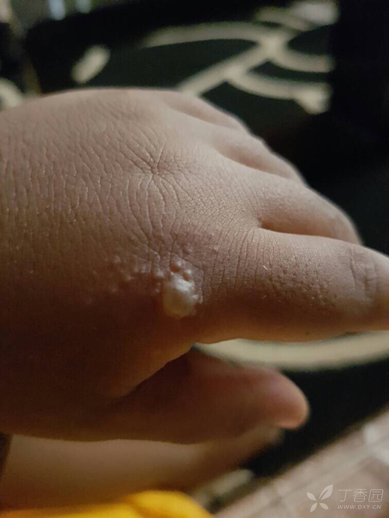 水泡如下,考虑啥?