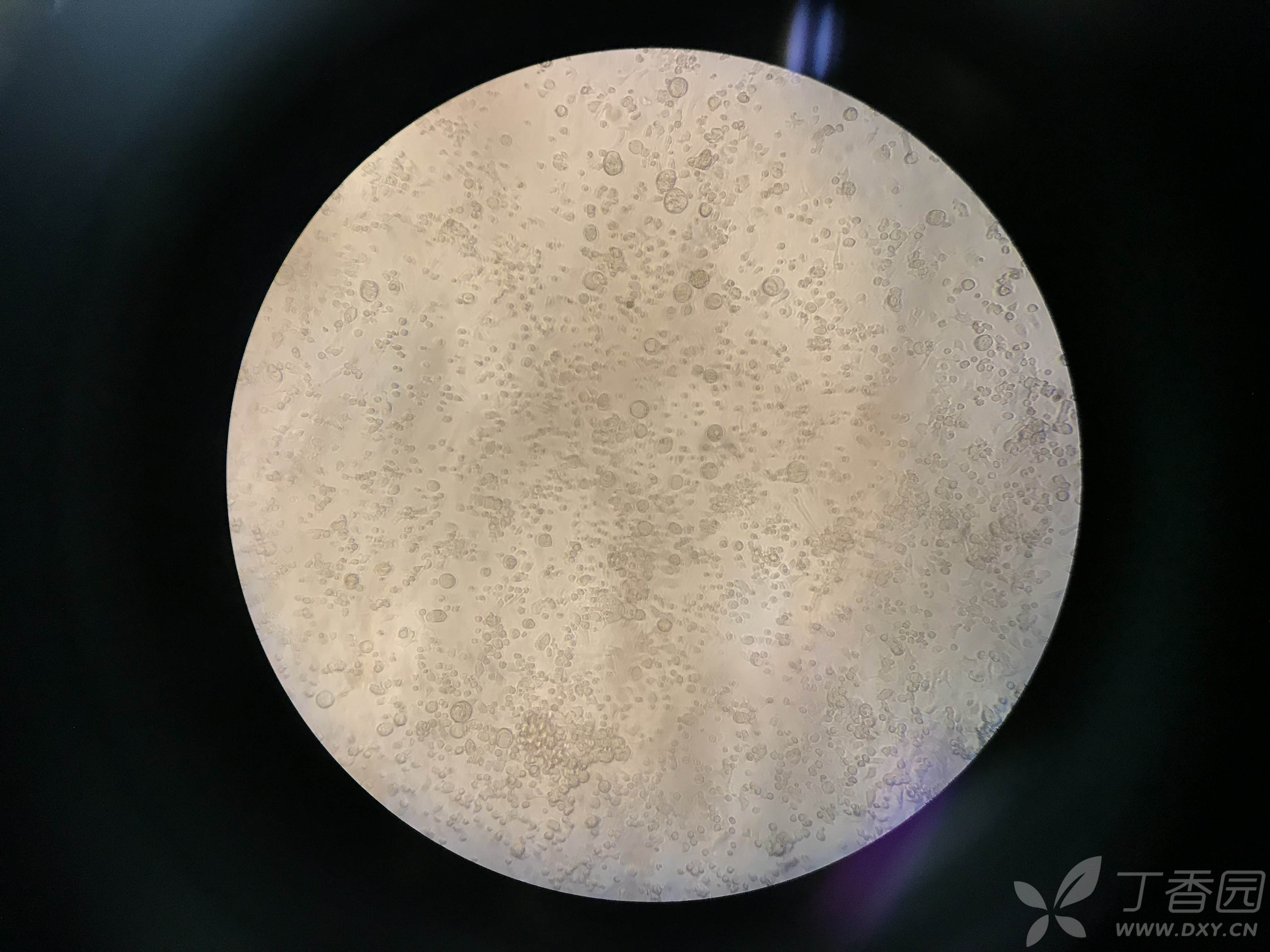 小鼠bmms诱导破骨细胞