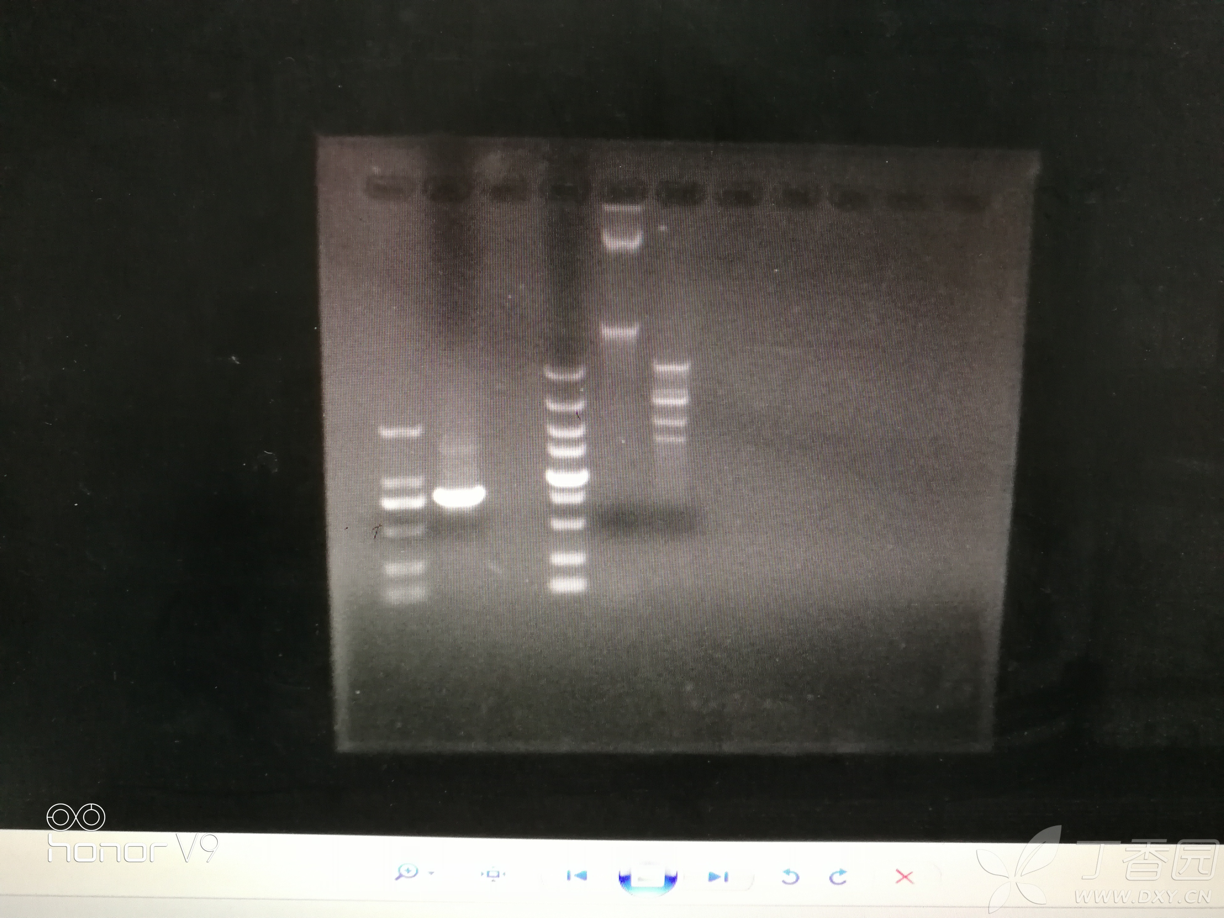 pet28a载体电泳图图片