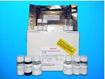 17-Beta-Hydroxysteroid Dehydrogenase Type 3 (HSD17b3) ELISA Kit, Human