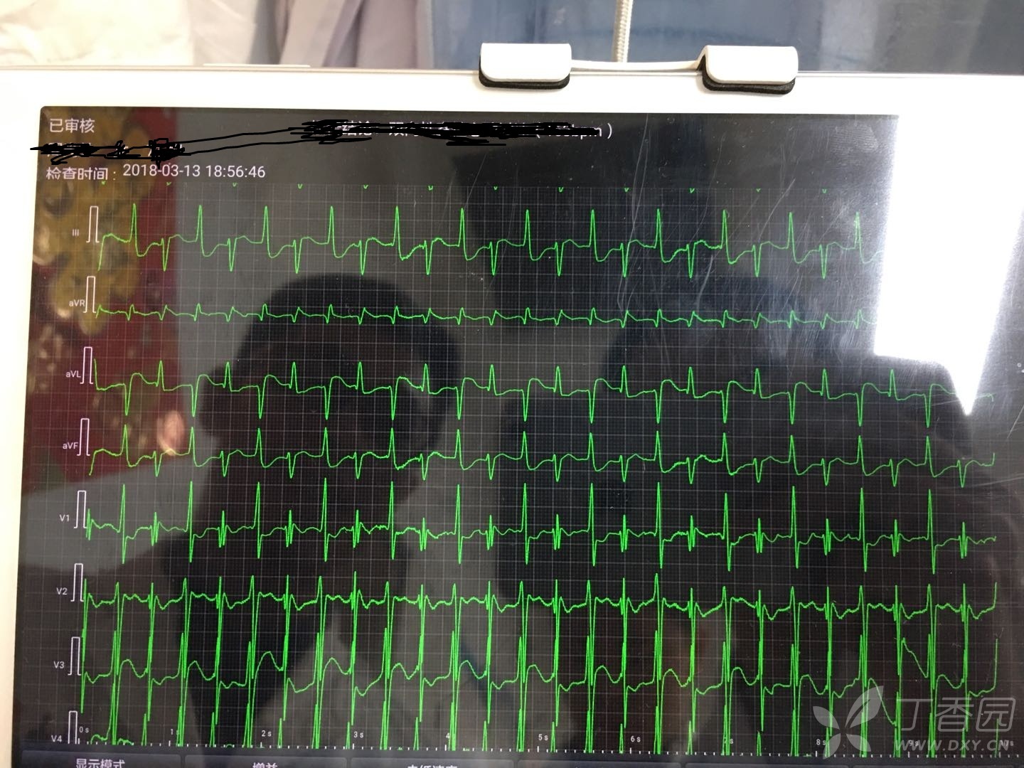 3269182348876671279-8w.jpg