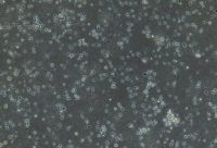 NK细胞/免疫荧光鉴定/流式检测